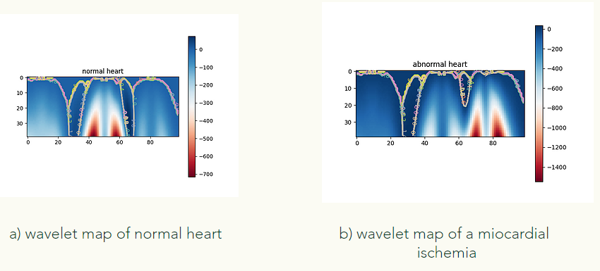 heart research